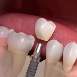 قسم-الأسنان